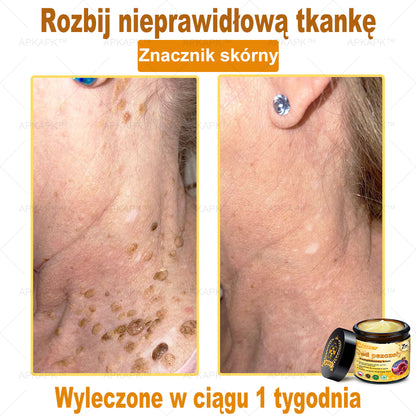 ΑPΚΑPK™ Jad Pszczoły Kompleksowy Krem🥇pomaga w leczeniu problemów skórnych, takich jak: zmarszczki, blizny, plamy pigmentacyjne, rozstępy, trądzik, łuszczyca, egzema, zmiany skórne, podrażnienia, stany zapalne i inne problemy skórne🔥