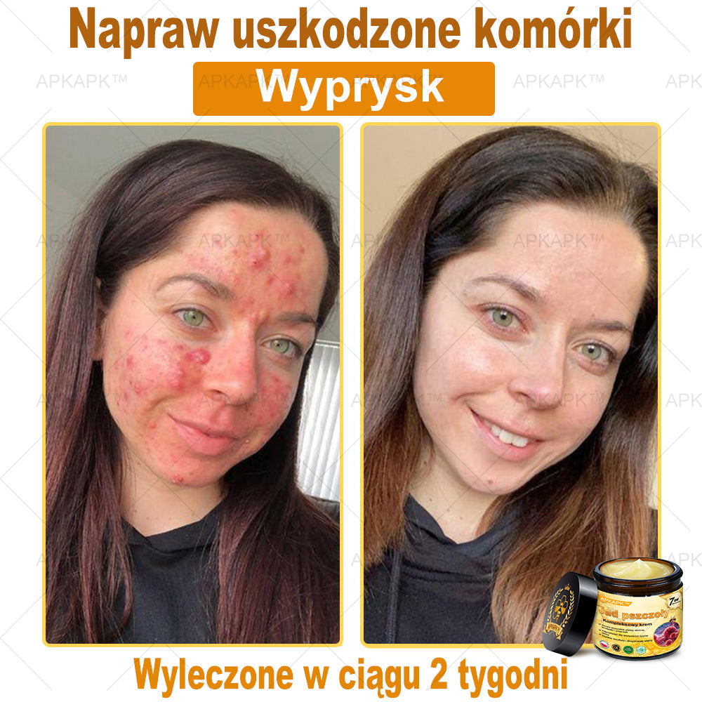 🎁 Zostało tylko 5 sztuk! Oferujemy dodatkową zniżkę 50%! Zdobądź formę i zdrowie. Nie czekaj, stracisz okazję, aż do przyszłego roku