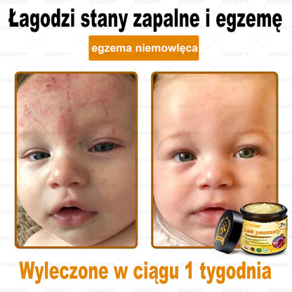 ΑPΚΑPK™ Jad Pszczoły Kompleksowy Krem🥇pomaga w leczeniu problemów skórnych, takich jak: zmarszczki, blizny, plamy pigmentacyjne, rozstępy, trądzik, łuszczyca, egzema, zmiany skórne, podrażnienia, stany zapalne i inne problemy skórne🔥