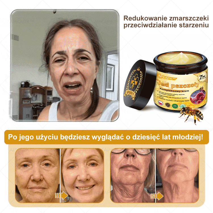 🎁 Zostało tylko 5 sztuk! Oferujemy dodatkową zniżkę 50%! Zdobądź formę i zdrowie. Nie czekaj, stracisz okazję, aż do przyszłego roku