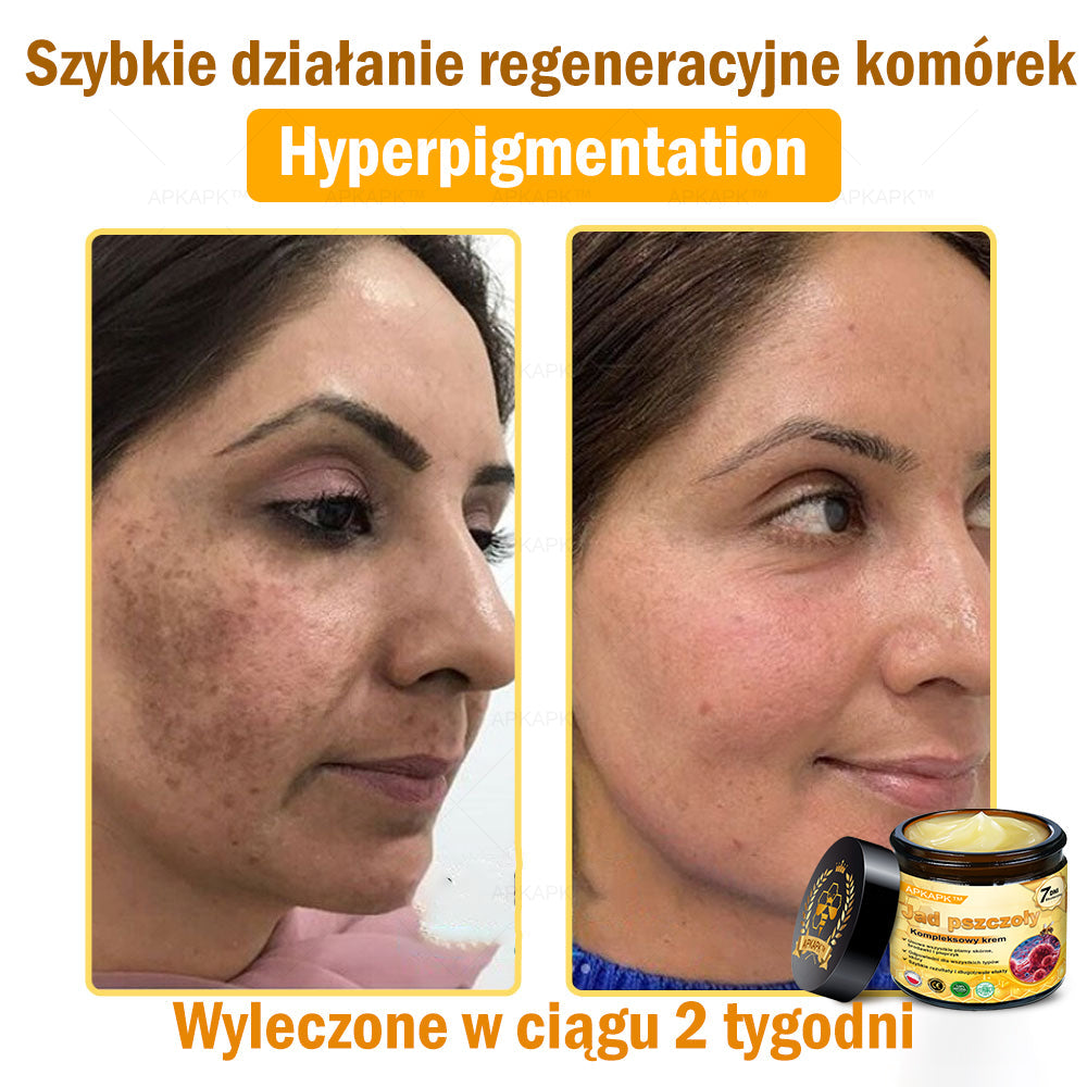 🎁 Zostało tylko 5 sztuk! Oferujemy dodatkową zniżkę 50%! Zdobądź formę i zdrowie. Nie czekaj, stracisz okazję, aż do przyszłego roku