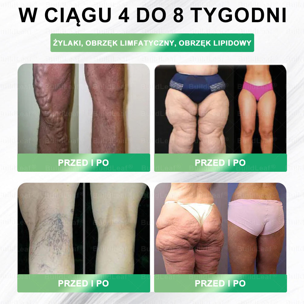 Oficjalny sklep Polska | ☘️BuildLeaf® GLP-1 8-w-1 Fit & Vital Rozwiązanie (Jednorazowe dziennie, widoczne zmiany w ciągu 7 dni) ✅ Otyłość, zdrowie sercowo-naczyniowe, cukrzyca, bezdech senny, zdrowie jelit, problemy ze stawami i inne.